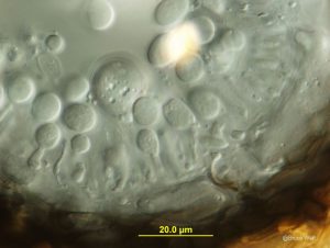 Vertical section of pycnidium- conidiogenesisVertical section of pycnidium - conidiogenesis