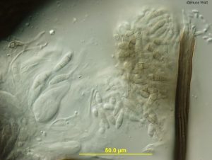 Ascus and septate ascospores (left & middle), neck of pycnidium with single-celled conidia (right)