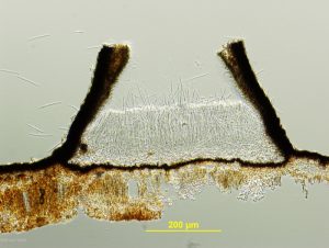 Vertical cross-section of apothecium with ascospores emerging