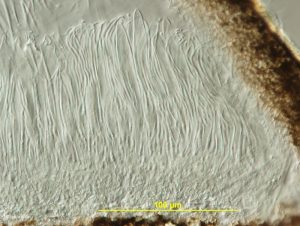 Vertical cross-section of apothecium with asci and paraphyses apparent