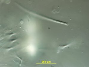 Ascospore with mucilagenous appendage apparent