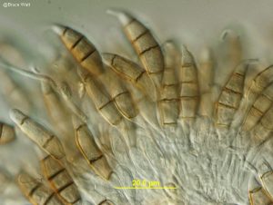 Vertical section of acervulus showing conidia on conidiophores.