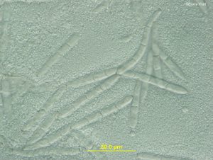Conidia on a tape mount