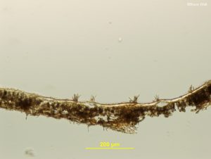 Side view of conidiophores emerging from leaf tissue