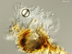 Poor vertical section of a pycnidium with conidia emerging