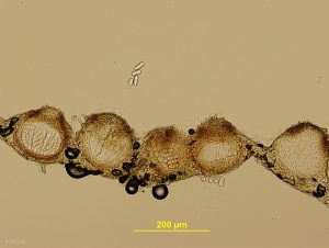 Pseudothecia, vertical section