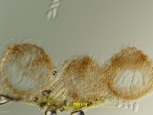 Pseudothecia, vertical section