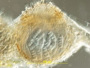 Pseudothecium, vertical section. Ascospores obvious.