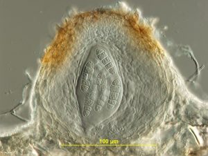 Pseudothecium, vertical section. Ascospores in ascus.