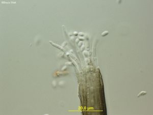 Tip of pycnidial neck with conidia escaping