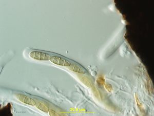 Ascospores in ascus