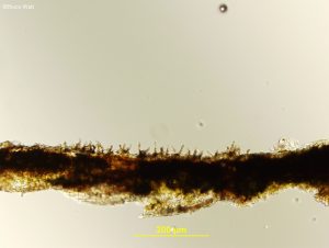 Leaf cross section with conidiophores evident
