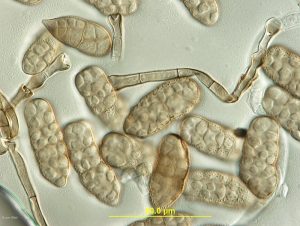Conidia, sectional view