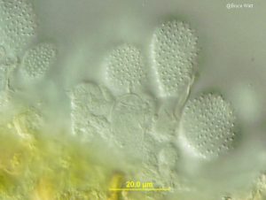 Surficial view of urediniospores on stalks