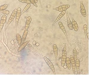 Early blight spores under a microscope (100x magnification).
