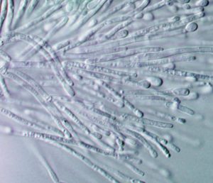 Fungal Conidia - Microscopic view