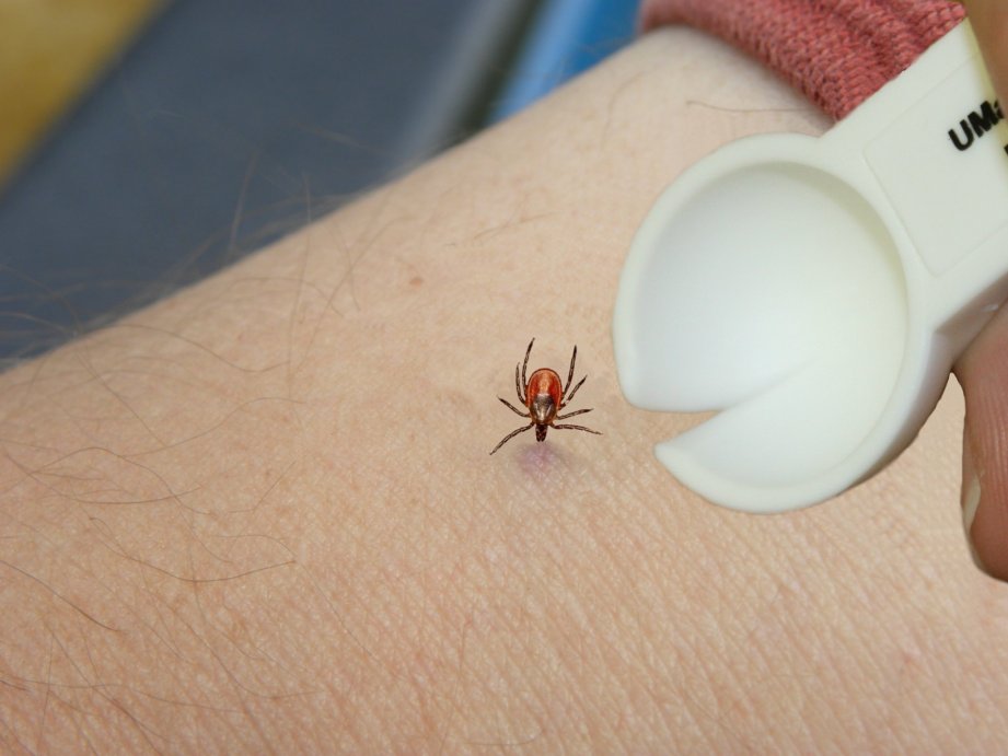 Tick Removal Cooperative Extension Tick Lab University Of Maine 