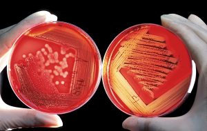 two red agar plates showing bacterial growth